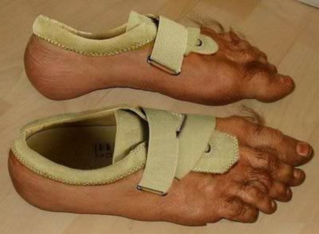 foot funny shoe pictures